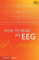 How to Read an EEG | نحوه خواندن EEG